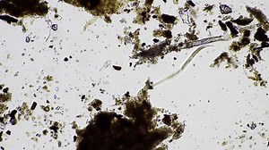 Nematode Microorganisms Soil Biology Nematodes Fungi Stock Footage Video (100% Royalty-free) 1101117505 | Shutterstock
