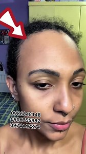 #noor #alta #HairMaskMagic #hairprotection #hairgoals #hairtransformation #hairtreatment #Noor #HairProblems | ኢትዮ beauty