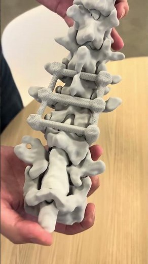 Inkbit Multi-Material Rigid+Soft Medical Model of a Real Human Spine #anatomy #3dprinting #medical