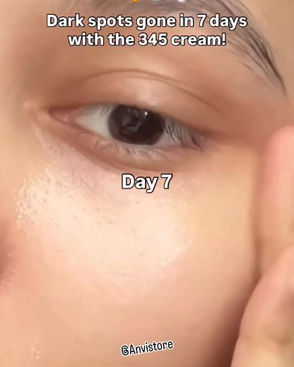 6.1K views · 43 reactions | Dr.Althea Relief Cream ❄️✨ #anvistore #authentic #goodproduct #products #beautyproducts #skin #skincare #skincareproducts #skincareroutine #skincaretips #skinhealth #SkincareTips | Anvi store | Facebook