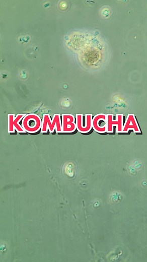 Understanding Kombucha: The Science Behind the Drink