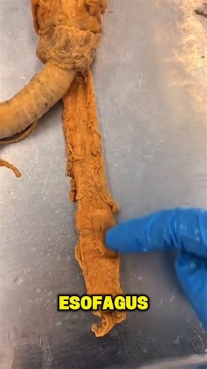 dr. Gia Pratama on Instagram: "Ini adalah 2 saluran di leher manusia. Esofagus dan Trakea itu lebih dikenal dengan nama kerongkongan dan tenggorokan. ------------------------------ PR : dimanakah posisi Pita suara manusia? #giaceritaanatomi #tentangtubuh #tenggorokan #kerongkongan Video : IOHA"