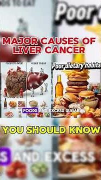 Major Causes of Liver Cancer , you should know #healtheducation #doctorlinda #generalphysician