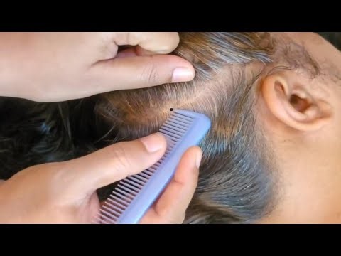Soothing Scalp Check & Treatment ASMR
