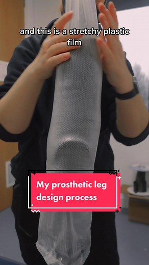 Customizing a Prosthetic Leg: The DIY Process