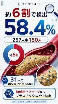 動脈硬化の中からプラスチック？患者の約6割で検出【医師解説】