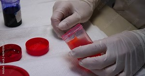 In the laboratory, a blood smear on a glass slide is stained with special dyes. In the laboratory, a blood smear is prepared to count the formed elements under a microscope. Clinical blood test. Stock Video