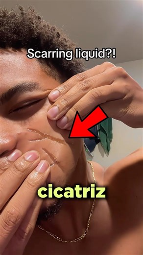 This scar is NOT what people thought…