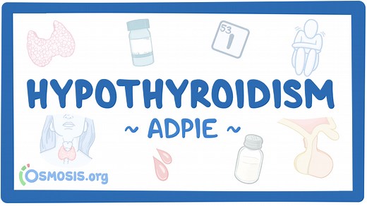 Hypothyroidism: Nursing process (ADPIE): Video, Causes, & Meaning | Osmosis