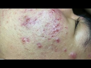 Relax Every Day SacDepSpa #958