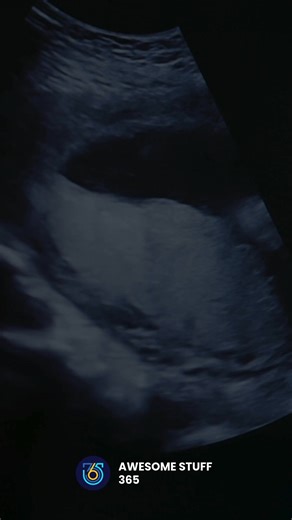 6.9K views · 131 reactions | Welcome to the future of life  Japan has just unveiled the world’s first fully functional artificial womb—a breakthrough that could redefine pregnancy and neonatal care. A monumental leap toward reshaping the possibilities of human life. How do you think this will impact our future?  #FutureOfLife #TechInnovation #HealthcareRevolution | Awesome Stuff 365 | Facebook