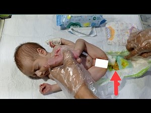 How to Change Diaper in Newborn Baby | Step-by-Step Neonatal Care | NICU Basics