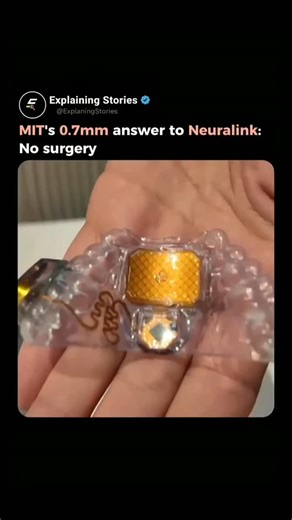 Explaining Stories on Instagram: "Neuralink vs. The MouthPad. 🧠👄 ​Forget skull surgery—MIT engineers just changed the game for accessibility. This is the MouthPad^TM, a 0.7mm wireless trackpad that sits on the roof of your mouth. ​✨ How it works: ​Tongue = Cursor: Just swipe and tap. ​Bluetooth: Connects to your phone, laptop, or tablet. ​No Surgery: It’s just a custom-fit dental retainer. ​Over 100 people with paralysis are already using this to write, code, and create for up to 9 hours a day