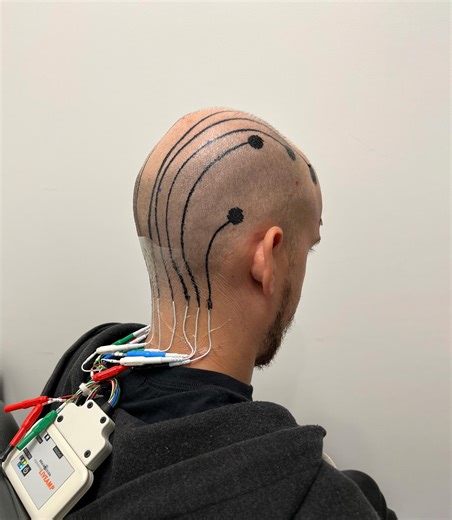 Mind-Reading Tattoos Revolutionize Brainwave Monitoring in Real-Time