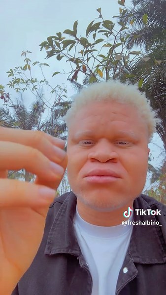 Albino Black Guy's Tips for Women