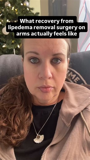Megan 🇺🇸 on Instagram: "Arm lipedema removal surgery recovery is a process. It’s uncomfortable, challenging, and requires patience—but relief doesn’t come without healing first. Save this for anyone preparing or recovering 💟 💪Tightness & swelling 💪Compression 24/7 💪Limited movement at first 💪Slow but meaningful progress #LipedemaSurgery #LipedemaAwareness #PostOpLife #lipedema #lipedemaandpain #lipedemajourney #lipedemawarriors #lipedemasupport #lipedemawarrior #lipedemacommunity #lipedem