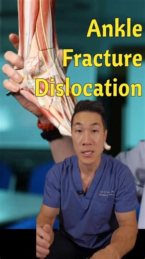 Jeff Yoo, MD | Emergency Physician | The worst ankle break you've never heard of 🦴 #medicine #doctor #ortho | Instagram
