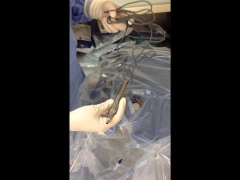 Preparación de sistema y pieza de mano de Alcon Infinity Cirugía de catarata