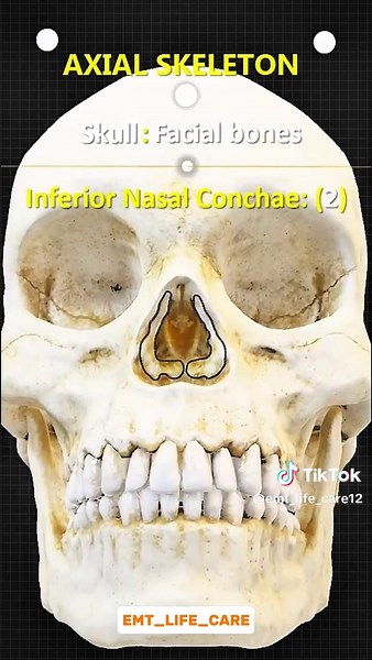 Exploring the Axial Skeleton: Skull Anatomy Refined