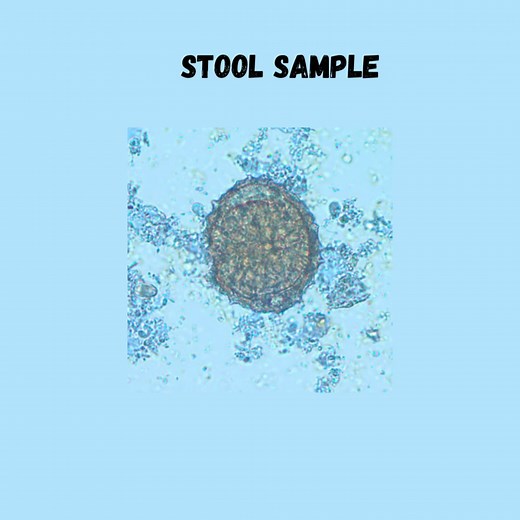 13K views · 261 reactions | Stool samples and blood sample ❤️. | Lab life | Facebook