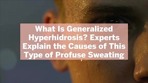 What Is Generalized Hyperhidrosis? Experts Explain the Causes of This Type of Profuse Swea