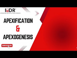 Apexogenesis & Apexification