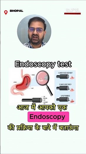 What is Endoscopy? | Reasons, Uses & Procedure Explained Simply