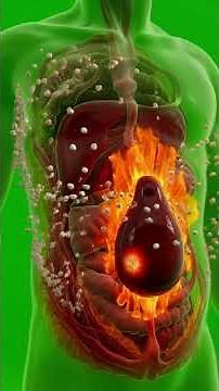 Gallbladder Disease Symptoms You Should NEVER Ignore