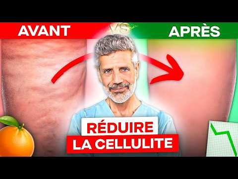 10 Tips to Get Rid of Cellulite in 2 Months