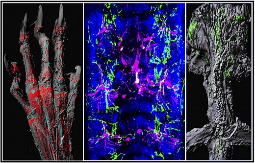 Role of lymphatic system in bone healing revealed | University of