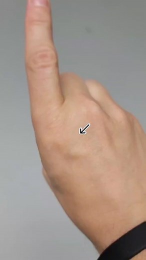 Understanding Finger Anatomy: Tendons and Muscles Explained