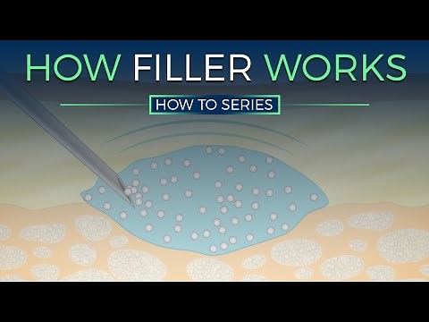 How Dermal Fillers Work - HOW TO SERIES