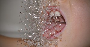 How to Shrink a Cold Sore: Herpes Expert Explains the Biology Behind the Best Treatments