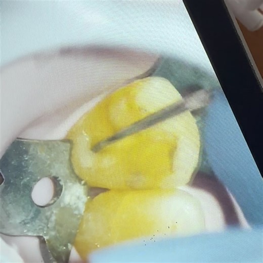 Addy Marisa Pacheco Rodriguez on Instagram: "ᴍᴀɴᴇᴊᴏ ᴅᴇ ᴄᴏɴᴅᴜᴄᴛᴏ ᴄᴀʟᴄɪꜰɪᴄᴀᴅᴏ ᴄᴏɴ ᴍᴀɢɴɪꜰɪᴄᴀᴄɪóɴ | ᴍᴀɴᴀɢᴇᴍᴇɴᴛ ᴏꜰ ᴄᴀʟᴄɪꜰɪᴇᴅ ᴄᴀɴᴀʟ ᴡɪᴛʜ ᴍᴀɢɴɪꜰɪᴄᴀᴛɪᴏɴ … Protocolo de Instrumentación: - #6 Manual - #8 Manual - #10 Manual - 13/02 C-Path File - R1 Sistema Rising - R2 Sistema Rising - R3 Sistema Rising - 35/04 Sistema AF F One Sistemas Rotatorios Fanta®️ @fantayucatan"