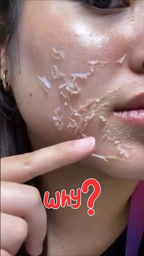 Why Is Your Skin Peeling Off? #shorts