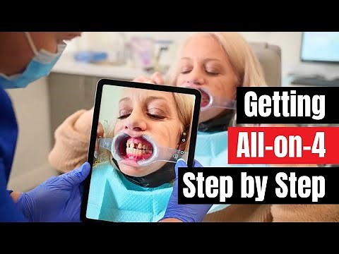 My Step-by-Step Process of Getting Permanent Teeth in 24 Hours