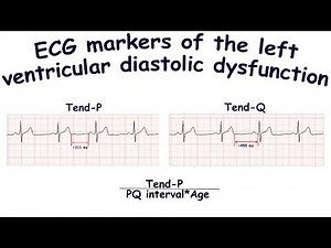 ECG markers of the left ventricular diastolic dysfunction: Tend-P, Tend-Q