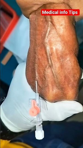 IV Cannulation Procces reels #ivcannulation #hospital #medicalteam #ivinsertion #doctor #anmnursing