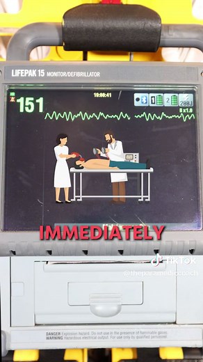 If you are using a #aed this is what a shockable rhythm looks like on a heart monitor. #emt #emtschool