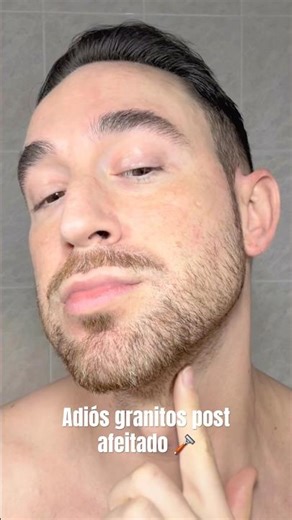 How to shave without bumps, Irritated skin after shaving 🪒 #skincare #beard #bumps #shaving