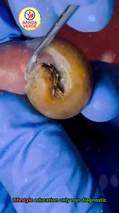 144K views · 1.3K reactions | Ep.693 Hotel stay calorie awareness and portion control  #CalorieControl #HeartHealthyDiet #WellnessLiving | Banda Verde | Facebook