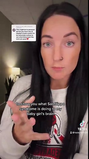 EDUCATION & ADVOCACY! “Brain atrophy or cerebral atrophy is the loss of brain cells called neurons. Atrophy also destroys the connections that help the cells communicate. It can be a result of many different diseases that damage the brain, including stroke and Alzheimer’s disease.” ( Sanfilippo Syndrome) What are the symptoms of brain atrophy? The symptoms of brain atrophy vary depending on which region or regions of the brain are affected. • Dementia-is the loss of memory, learning, abstract th