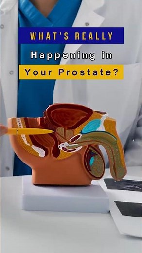 The Prostate: What Every Man Should Know