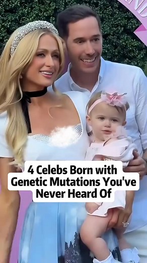 121K views · 883 reactions | 4 celebs born with genetic mutations you’ve never heard of #celebrity #hollywood #fyp #celebrities #usa #foryoupage #capcut #famous #movie #heard | Celebrity Gossipe | Facebook