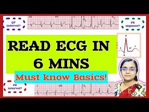 How to Read an ECG for Beginners | ECG Basics & PQRST Waves Explained