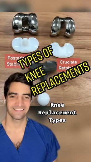 Types of Knee Replacements Explained