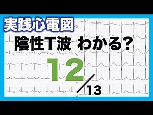 [How to read an electrocardiogram ⑫] Negative T waves, QT prolongation