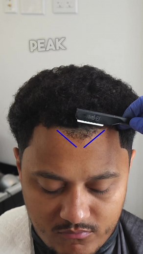 How to Cut a Client's Hair with a Widow's Peak