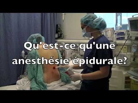 4. Anesthésie Épidurale