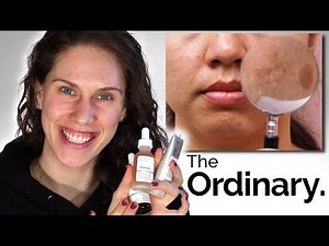 THE ORDINARY - 3 BEST DARK SPOTS & PIGMENTATION PRODUCTS